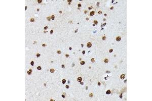 Immunohistochemistry (IHC) image for anti-Heterogeneous Nuclear Ribonucleoprotein M (HNRNPM) (AA 491-730) antibody (ABIN6141919)
