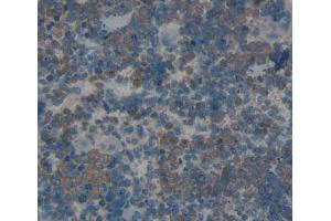 Used in DAB staining on fromalin fixed paraffin- embedded spleen tissue (SKAP1 抗体  (AA 1-354))