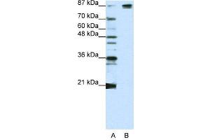 WB Suggested Anti-SF3B1  Antibody Titration: 1. (SF3B1 抗体  (Middle Region))
