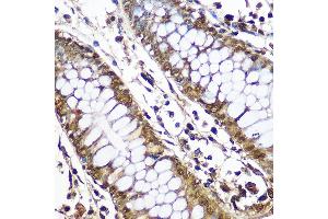 Immunohistochemistry (IHC) image for anti-CCR4-NOT Transcription Complex, Subunit 7 (CNOT7) (AA 90-160) antibody (ABIN6138783)