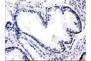 Immunohistochemical staining of paraffin-embedded Human Kidney tissue using anti-ALDH1L1 mouse monoclonal antibody. (ALDH1L1 抗体)