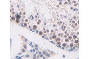 Used in DAB staining on fromalin fixed paraffin- embedded testis tissue (HMGB4 抗体  (AA 25-167))