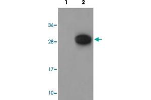 Western blot analysis of Lane 1: antigen-specific peptide treated 3T3 cells, Lane 2: 3T3 cells with GAB2 (phospho Y643) polyclonal antibody  at 1:500-1000 dilution. (GAB2 抗体  (pTyr643))