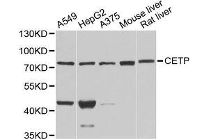 Western blot analysis of extracts of various cell lines, using CETP antibody. (CETP 抗体  (AA 300-493))