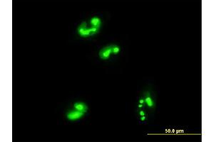 Immunofluorescence of monoclonal antibody to C1orf33 on HepG2 cell. (C1orf33 抗体  (AA 1-239))