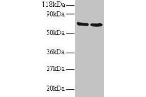 Western blot All lanes: IFITM1 antibody at 2 μg/mL Lane 1: EC109 whole cell lysate Lane 2: 293T whole cell lysate Secondary Goat polyclonal to rabbit IgG at 1/15000 dilution Predicted band size: 14 kDa Observed band size: 70 kDa (IFITM1 抗体  (AA 1-36))