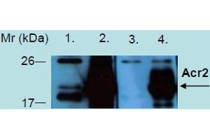 Western Blotting analysis of recombinant protein Acr2 produced in Escherichia coli BL21 (lambdaDE3) transfected bacterial culture. (Acr2 - heat stress induced ribosome binding protein A 抗体)