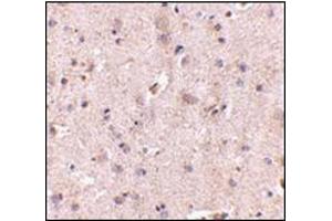 Immunohistochemistry of SAPAP2 in human brain with this product at 5 μg/ml. (DLGAP2 抗体  (Center))