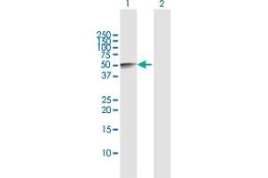 Western Blot analysis of SERPINE1 expression in transfected 293T cell line by SERPINE1 MaxPab polyclonal antibody.