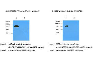 Western Blotting (WB) image for anti-Herpes Virus Type 8 (HHV8) (AA 122-329) antibody (ABIN371871) (HHV8 抗体  (AA 122-329))