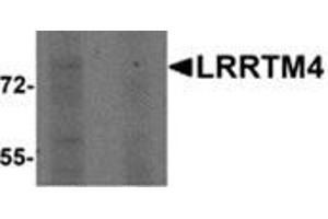 Western blot analysis of LRRTM4 in HeLa cell lysate with LRRTM4 antibody at 1 μg/ml in (left) the absence and (right) the presence of blocking peptide. (LRRTM4 抗体  (Center))