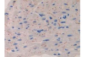 Detection of IL11Ra in Mouse Heart Tissue using Polyclonal Antibody to Interleukin 11 Receptor Alpha (IL11Ra)