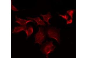 ABIN6275598 staining COLO205 by IF/ICC. (SLCO1B1 抗体)