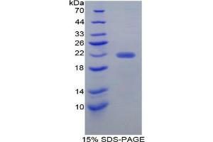 SDS-PAGE analysis of Mouse Ficolin 2 Protein. (Ficolin 2 蛋白)
