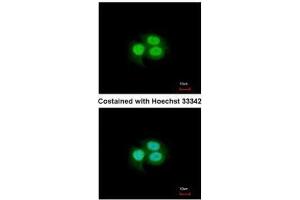 ICC/IF Image Immunofluorescence analysis of paraformaldehyde-fixed A549, using MSI1, antibody at 1:200 dilution. (MSI1 抗体  (Center))