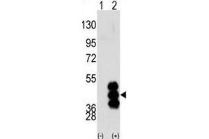 Western Blotting (WB) image for anti-phosphorylase Kinase, gamma 2 (Testis) (PHKG2) antibody (ABIN3003064)