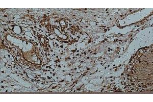 Immunohistochemistry of paraffin-embedded Human colon using Galectin 3 Monoclonal Antibody at dilution of 1:50. (Galectin 3 抗体)