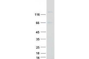 Western Blotting (WB) image for Serine/threonine Kinase 10 (STK10-A) protein (Myc-DYKDDDDK Tag) (ABIN2732858)