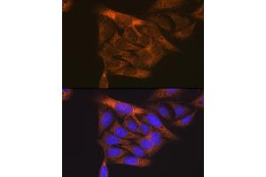 Immunofluorescence analysis of U2OS cells using VEGFR1 antibody (ABIN1683256, ABIN3015026, ABIN3015027 and ABIN6213602) at dilution of 1:100. (FLT1 抗体  (AA 1100-1200))