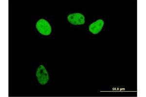 Immunofluorescence of purified MaxPab antibody to RPA1 on HeLa cell. (RPA1 抗体  (AA 1-616))
