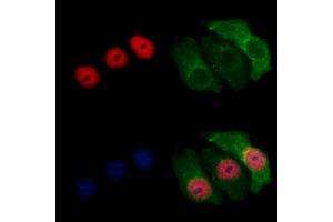 ABIN7094046 and ABIN7098090 staining Hela cells by IF/ICC.