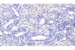 Detection of MFN1 in Human Kidney Tissue using Polyclonal Antibody to Mitofusin 1 (MFN1) (MFN1 抗体  (AA 1-227))