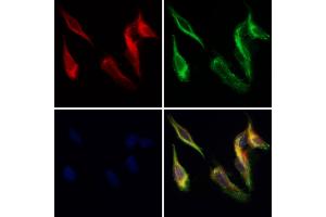 CRISP3 Antibody staining Hela cells by IF/ICC. (CRISP3 抗体  (Internal Region))