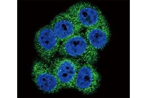 Confocal immunofluorescent analysis of DDR1 antibody with 293 cells followed by Alexa Fluor 488-conjugated goat anti-rabbit lgG (green).