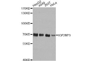 Western blot analysis of extracts of various cell lines, using IGF2BP3 antibody. (IGF2BP3 抗体  (AA 300-579))