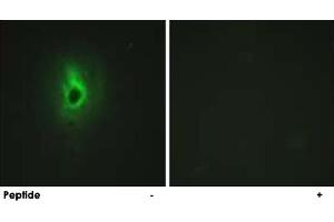 Immunofluorescence analysis of HeLa cells, using COL6A3 polyclonal antibody . (COL6a3 抗体  (AA 2261-2310))