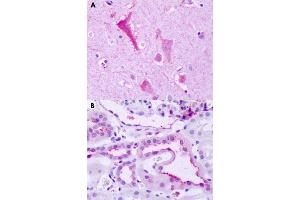 Immunohistochemical staining of formalin-fixed paraffin-embedded human brain, neurons (A) and human kidney (B) with GPR137B polyclonal antibody . (GPR137B 抗体  (C-Term))