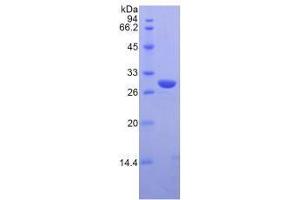SDS-PAGE analysis of Mouse IRAK2 Protein. (IRAK2 蛋白)