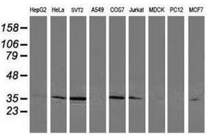 Image no. 2 for anti-Cyclin-Dependent Kinase 2 (CDK2) antibody (ABIN1497399) (CDK2 抗体)