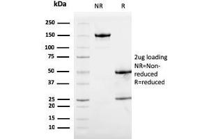 SDS-PAGE Analysis Purified Calprotectin Mouse Monoclonal Antibody (S100A9/1075). (S100A9 抗体)