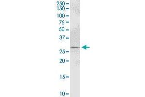 PYCR1 MaxPab polyclonal antibody. (PYCR1 抗体  (AA 1-319))