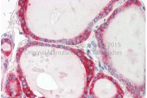 Rabbit Anti-CALR Antibody Catalog Number: ARP58123 Formalin Fixed Paraffin Embedded Tissue: Human Adult Thyroid  Observed Staining: Cytoplasm in hepatocytes Primary Antibody Concentration: 1:600 Secondary Antibody: Donkey anti-Rabbit-Cy3 Secondary Antibody Concentration: 1:200 Magnification: 20X Exposure Time: 0.
