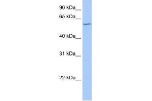 WB Suggested Anti-DNTT Antibody Titration: 0. (TdT 抗体  (N-Term))