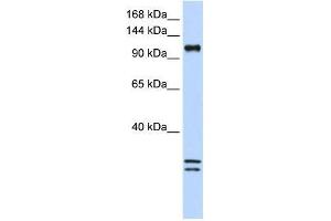 Western Blot showing NCKAP1L antibody used at a concentration of 1-2 ug/ml to detect its target protein.