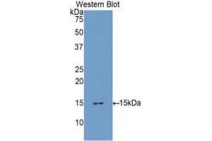 WB of Protein Standard: different control antibodies against Highly purified E. (FURIN ELISA 试剂盒)