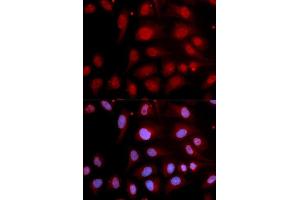 Immunofluorescence analysis of U2OS cell using POLB antibody. (POLB 抗体  (AA 1-335))