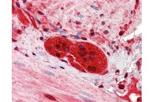IHC Information: Paraffin embedded small intestine, myenteric plexus tissue, tested with an antibody dilution of 2. (ZEB2 抗体  (Middle Region))