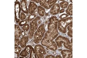 Immunohistochemical staining (Formalin-fixed paraffin-embedded sections) of human kidney shows strong cytoplasmic positivity in tubular cells. (PAX3 and PAX7 Binding Protein 1 (PAXBP1) 抗体)