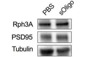 Primary cultures of rat hippocampal neurons were treated at DIV9 with either 2 μg/μl sOligo or PBS and analyses were performed at DIV16.