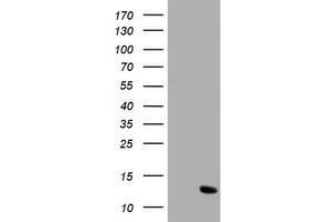 Image no. 1 for anti-Chromosome 17 Open Reading Frame 37 (C17orf37) antibody (ABIN1501779) (C17orf37 抗体)