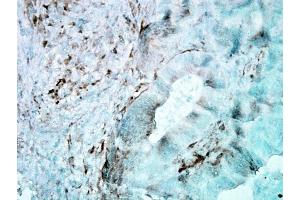 Immunohistochemistry (IHC) image for anti-Heat Shock 27kDa Protein 1 (HSPB1) antibody (ABIN361756)