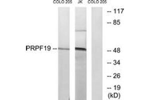 Western blot analysis of extracts from COLO/Jurkat cells, using PRPF19 Antibody. (PRP19 抗体  (AA 171-220))
