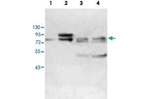 Western blot analysis of human fetal kidney (Lane 1) and MCF-7 cell (Lane 2), K-562 cell (Lane 3) and HeLa cell (Lane 4) lysates with ABCF3 polyclonal antibody  at 1 : 500 dilution. (ABCF3 抗体  (AA 442-681))