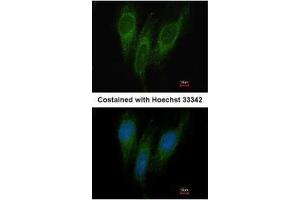 ICC/IF Image Immunofluorescence analysis of methanol-fixed HeLa, using DNAJC1, antibody at 1:200 dilution. (DNAJC1 抗体  (Center))