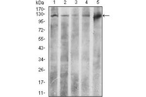 Western Blotting (WB) image for anti-ATP Citrate Lyase (ACLY) (AA 306-502) antibody (ABIN1842880)