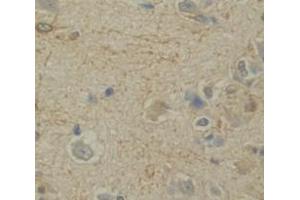 Used in DAB staining on fromalin fixed paraffin- embedded Kidney tissue (NRN1 抗体  (AA 28-142))